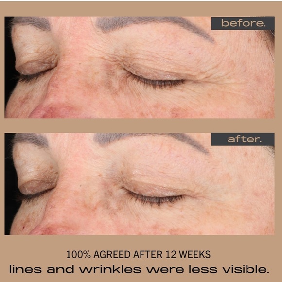 Matter of fact brightening + firming serum 20% vitamin C + ferulic acid - Picture 3 of 3